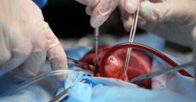 В Латвии успешно проведена первая в этом году трансплантация сердца - rus.delfi.lv - Рига - Латвия