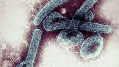 Гана сообщает о первой вспышке вируса Марбург - unn.com.ua - Украина - Киев - Гана - Юар - Конго - Ангола - Кения - Уганда - Гвинея